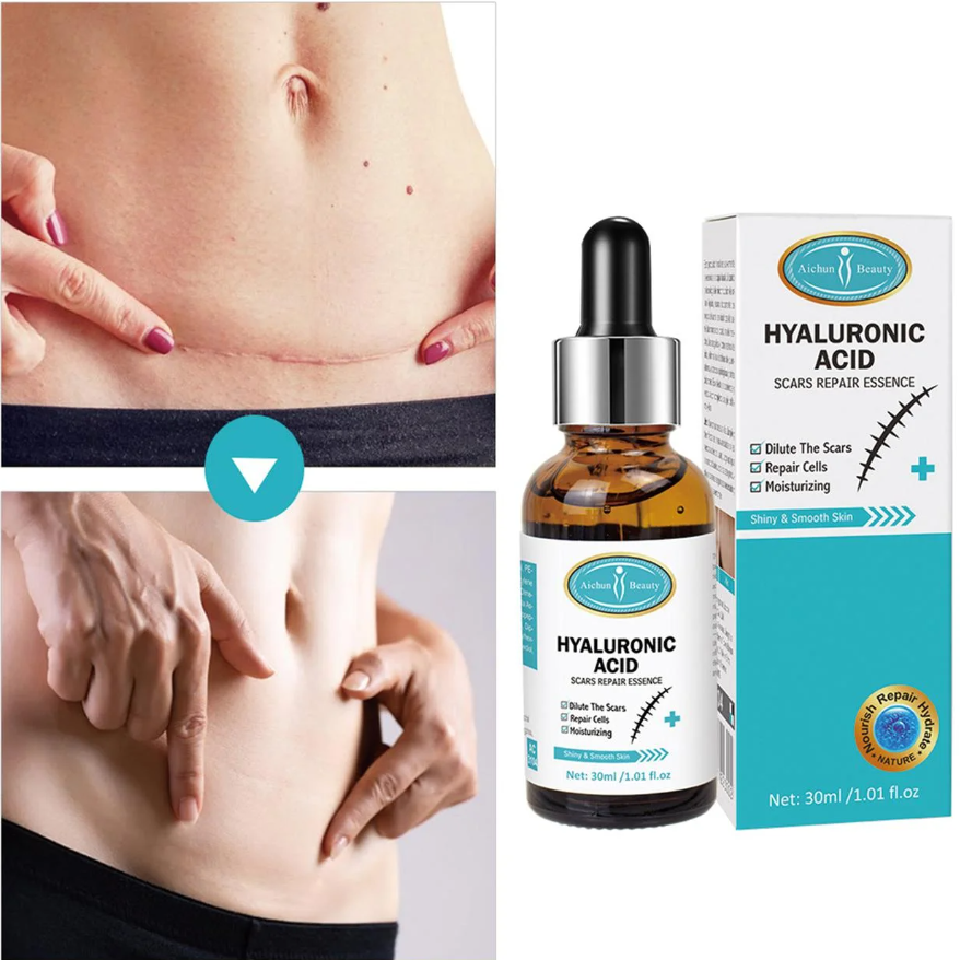 HYALURONIC ACID