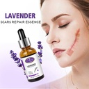 LAVENDER SCAR REPAIR