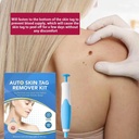 SKIN TAGS REMOVER